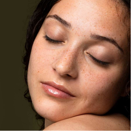 Aplicação de peeling químico